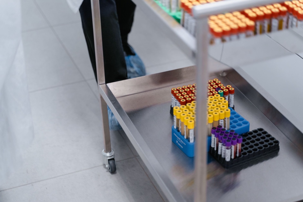 Occident, laboratoire de tests de batteries
